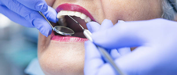 Best Dentist Open on Weekends  in Limesa, CA